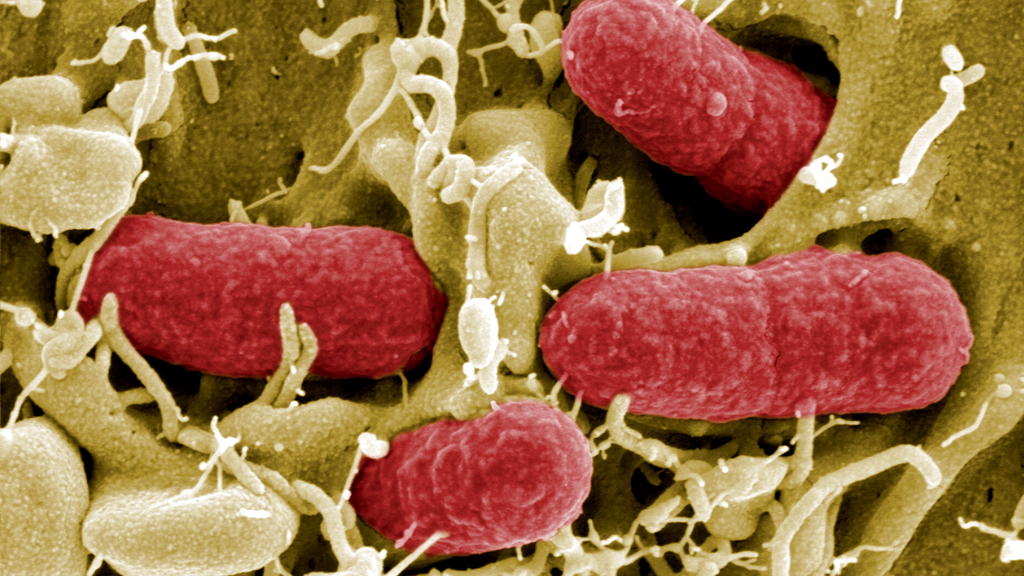 EHEC-Bakterien unter dem Mikroskop