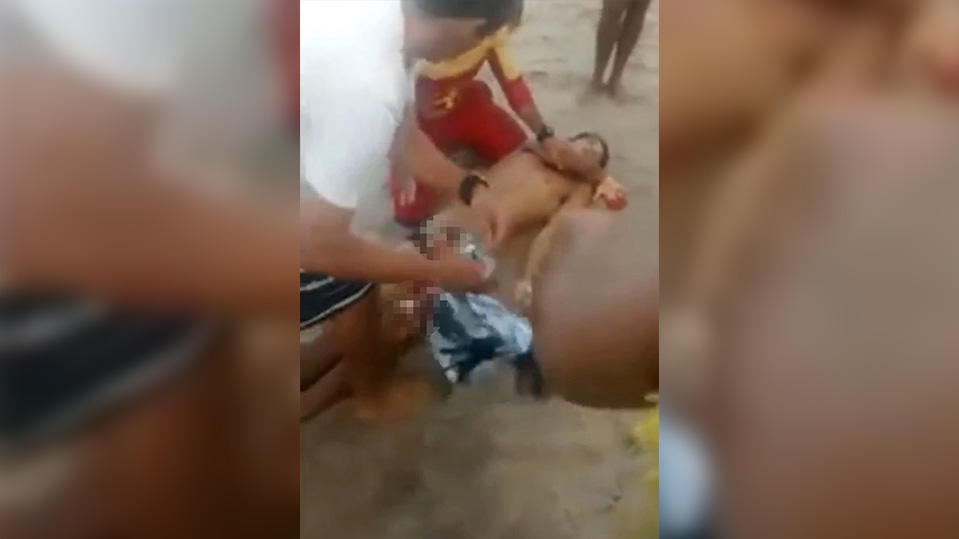 Der 18-Jährige wurde bei Recife von einem Hai angegriffen