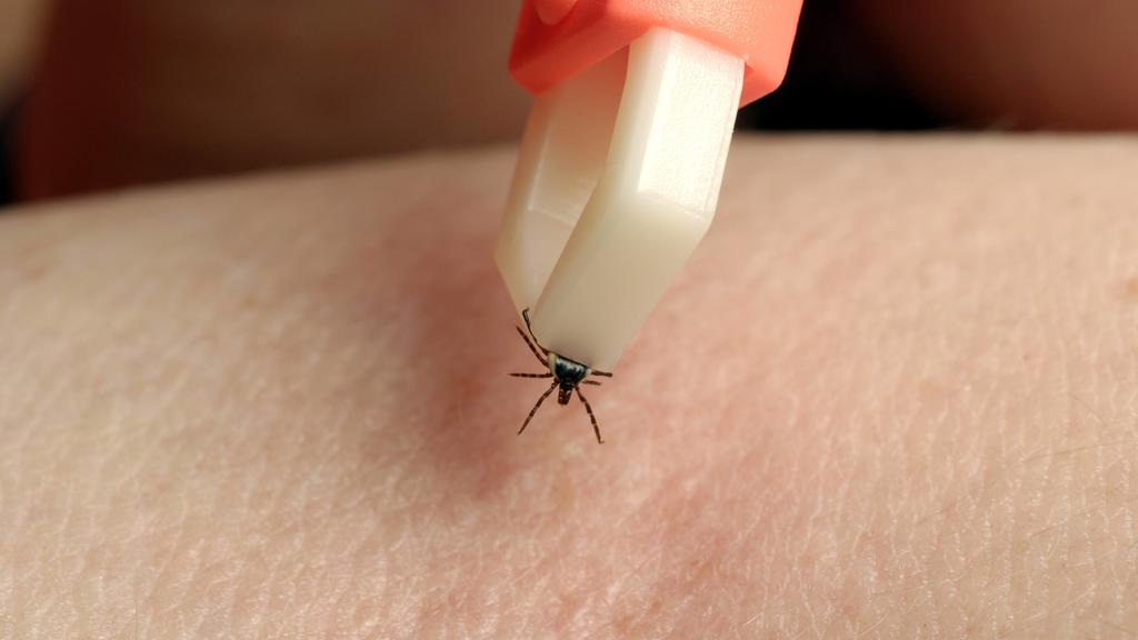 Eine Zeckenzange eignet sich gut, um die kleinen Insekten zu entfernen.