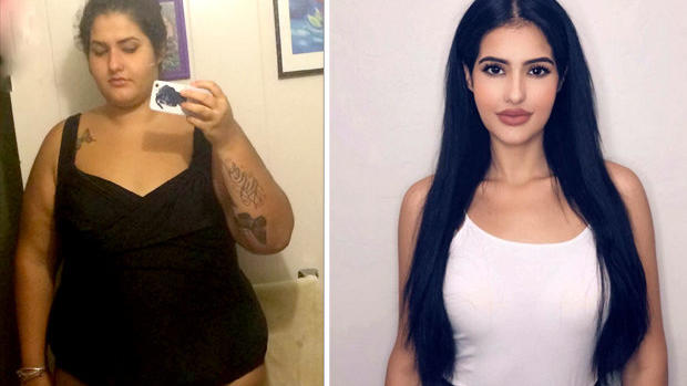Shantel Carrillo aus San Diego vor und nach ihrer Magenverkleinerung.