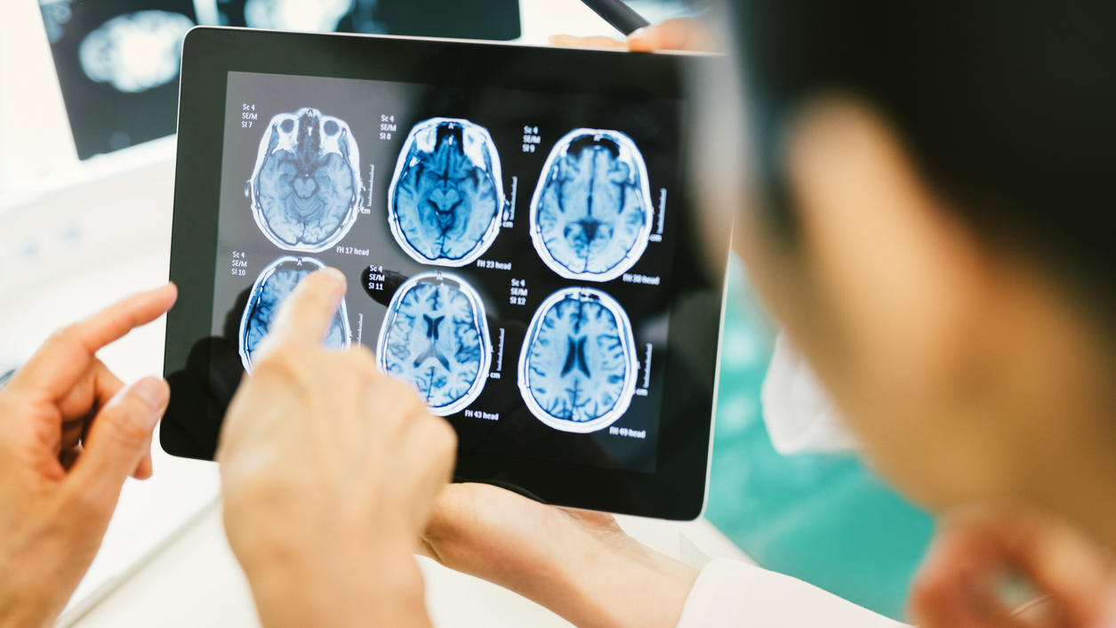 Ärzte schauen auf Hirn-Scans mit einem Hirntumor