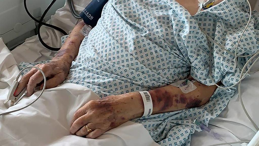 London 98-Jähriger überfallen und geschlagen