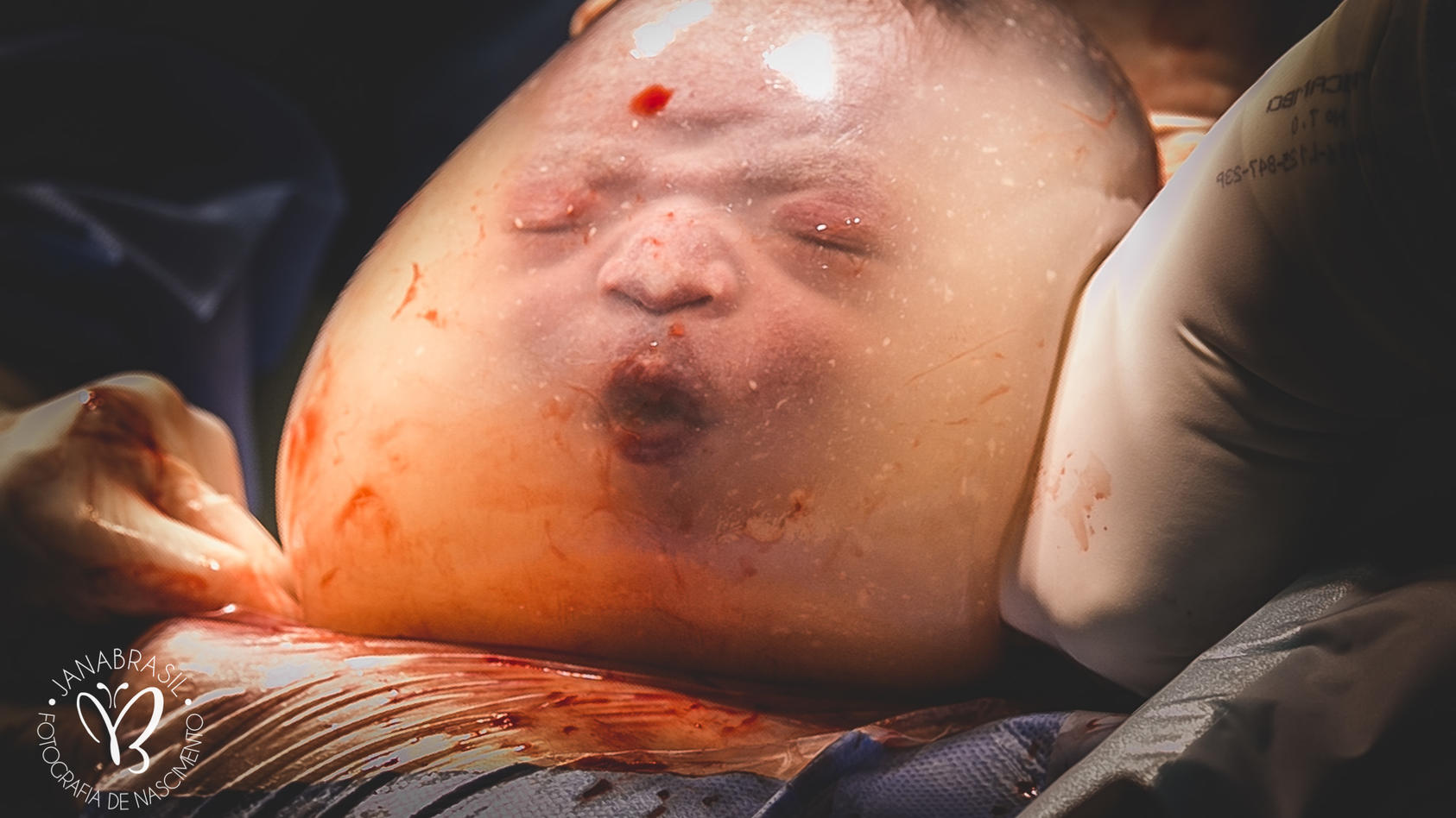 Baby in Fruchtblase geboren