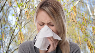 Frau niest mit Taschentuch Frühling Allergie