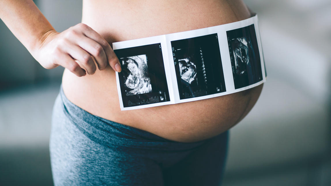 Ultraschalluntersuchungen bei Schwangeren nötig