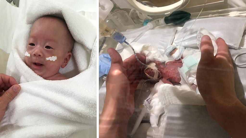 Nach fünf Monaten in der Klinik ist der nun so schwer wie andere Babys bei ihrer Geburt.