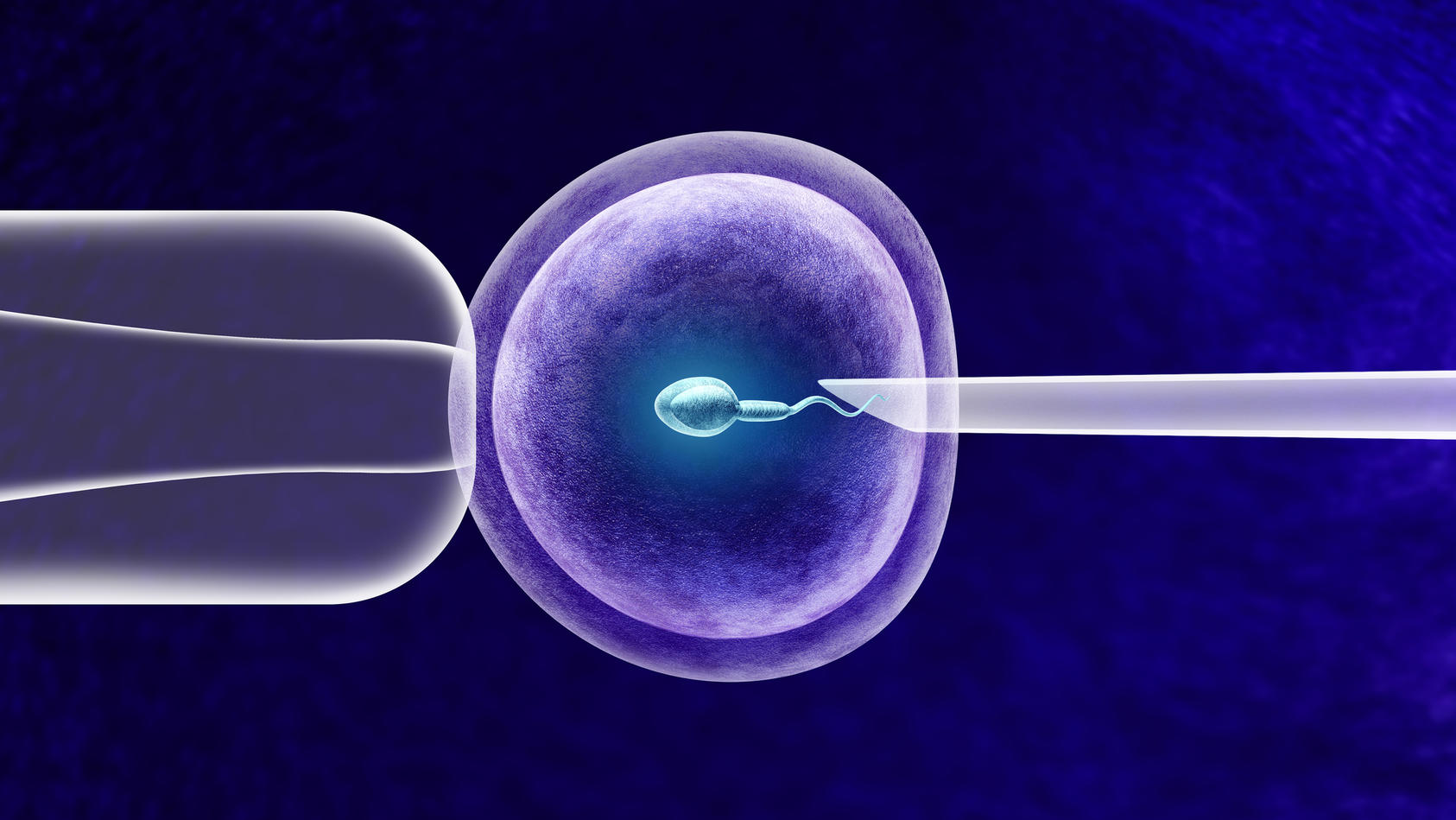 In-vitro-Fertilisation