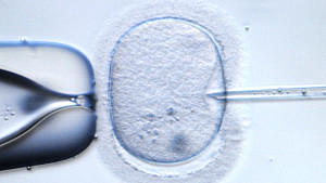 Dürfen menschliche Embryonen zerstört werden, um Stammzellen zu erzeugen? Nein, sagt ein EU-Gericht.