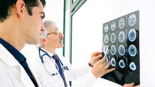 Doctors consult over an MRI scan of the brain.