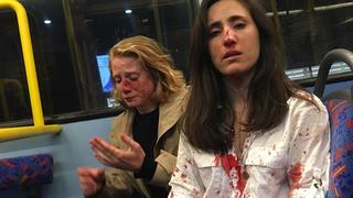Melania Geymonat postete auf Facebook ein Bild von sich und ihrer Freundin nach der Attacke.