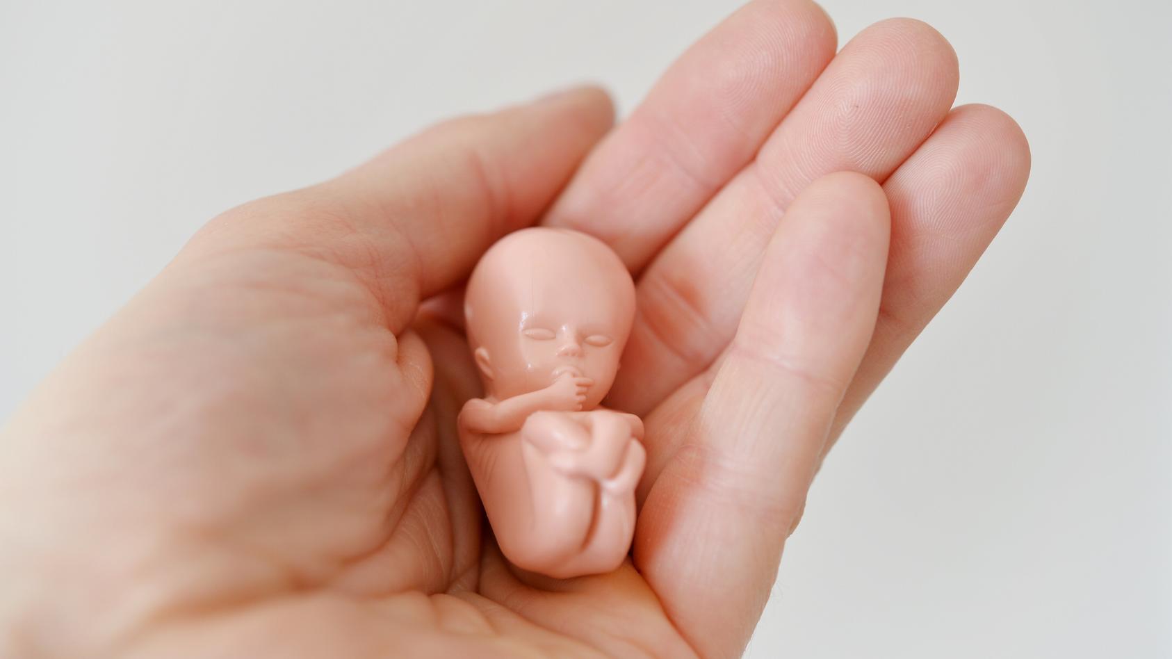 Abtreiben schwanger Abtreibung: Kosten,