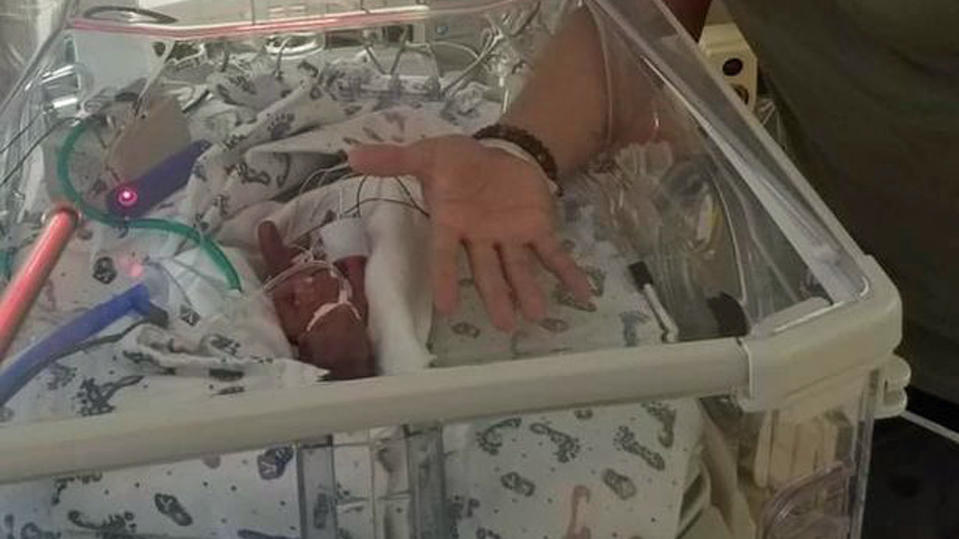 US-Amerikanerin brachte ihr Baby im 5. Monat zur Welt