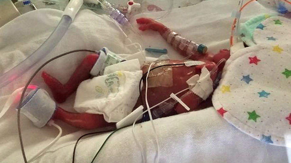 Minibaby in den USA geboren.