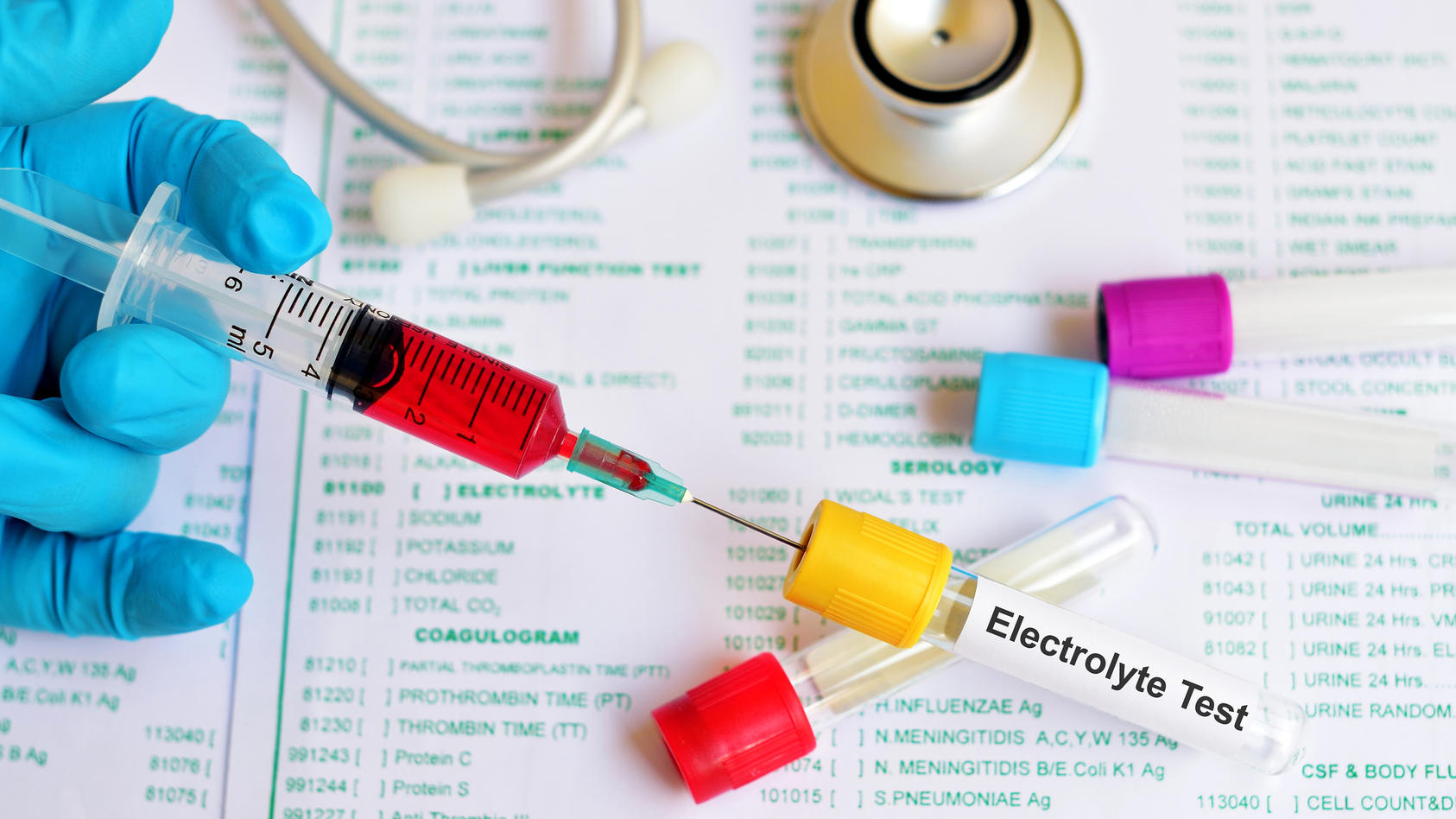 Gesundheitslexikon: Elektrolyte sind lebensnotwendig für uns