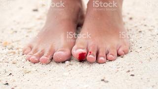 Verletzter Fuß am Strand