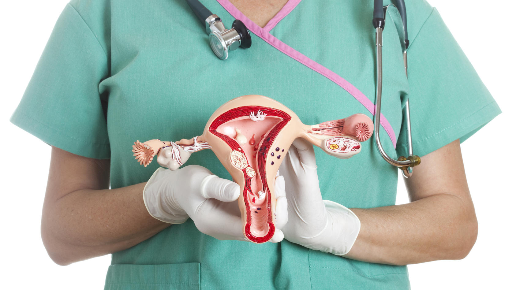 Der Gebärmutterkrebs, das Uteruskarzinom, ist ein bösartiger Tumor der Gebärmutter.