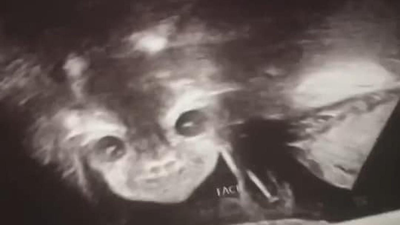 Iyanna Carrington Ultraschallbild ihres Kindes