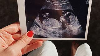 Ira Meindl Ultraschall-Bild ihres zweiten Nachwuchses