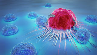 Abbildung Krebszelle und Lymphozyten