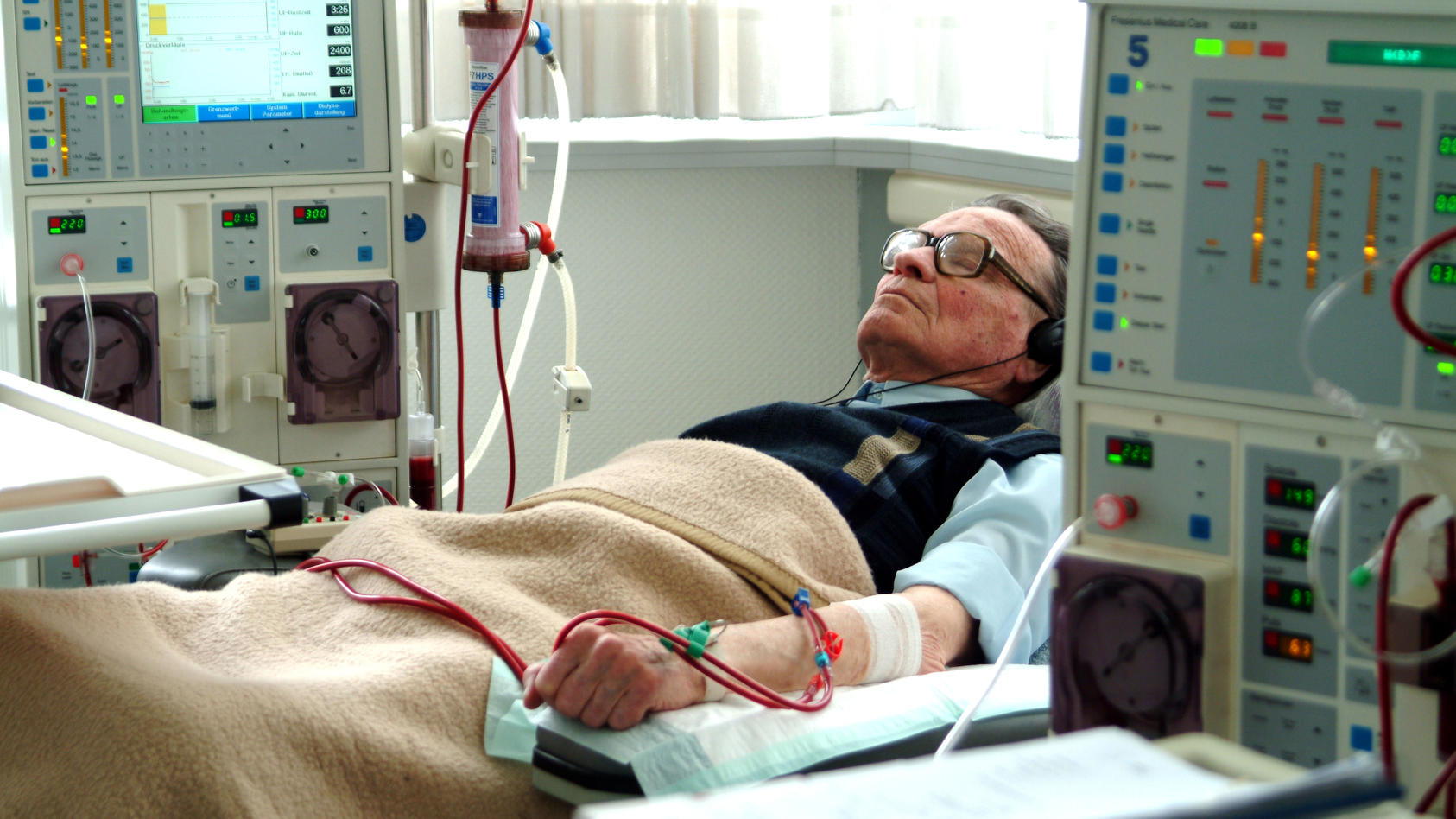 Ein Patient mit Kopfhörern und geschlossenen Augen entspannt sich bei Musik während der Blutwäsche am Dialyse-Gerät.