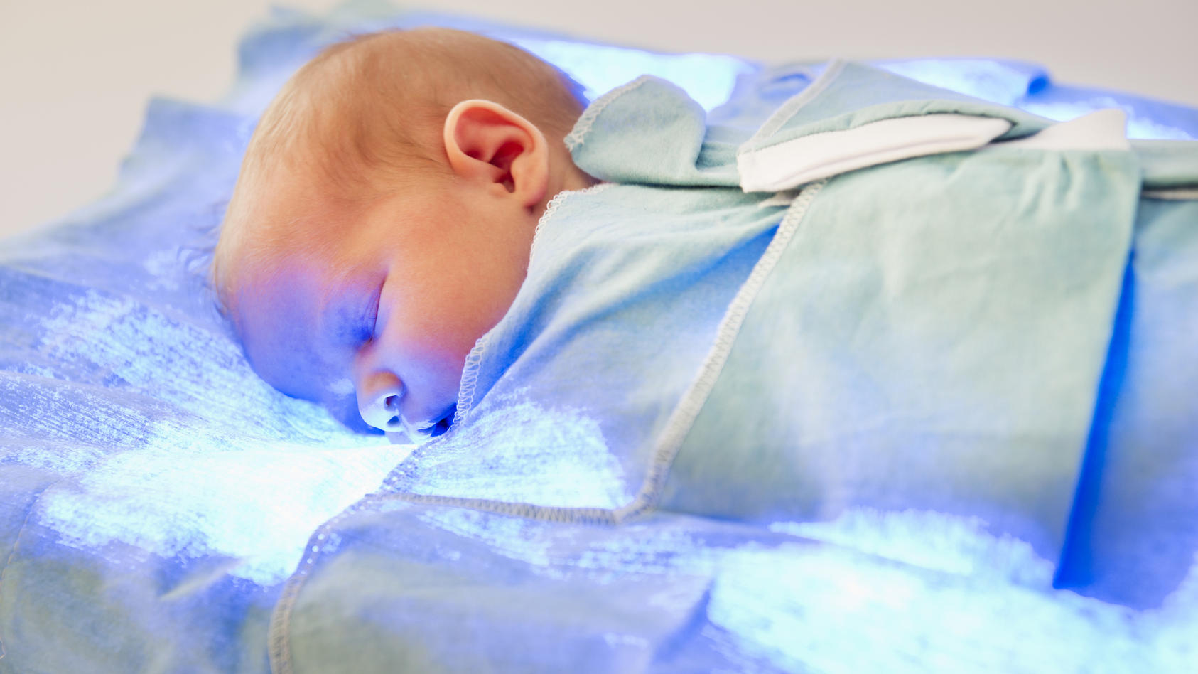 Fototherapy bei Neugeborenen-Gelbsucht (Kernikterus)
