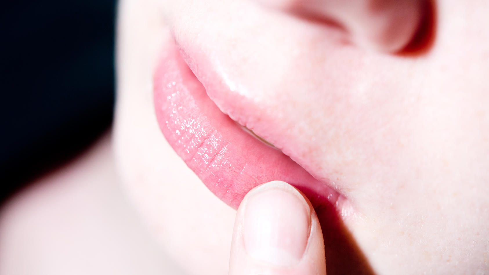 Eine Frau befühlt mit einem Finger eine juckende und schmerzende Stelle auf ihrer Lippe.