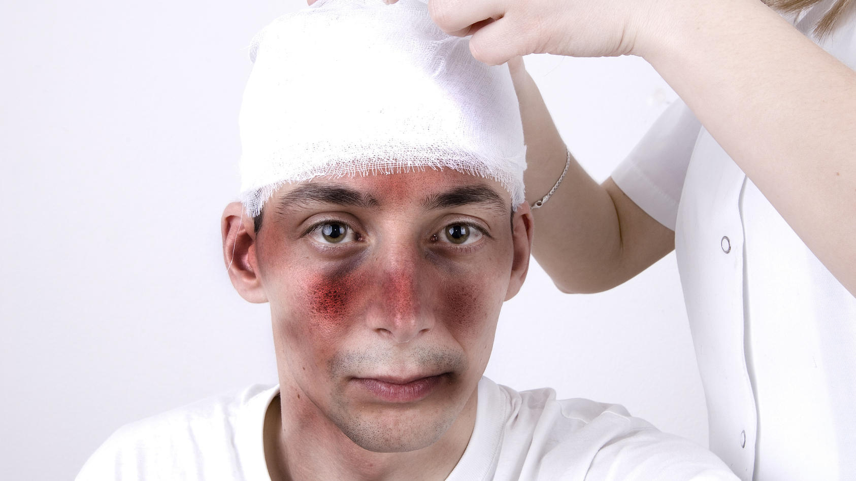 Mann mit Kopfverletzung (Schädel-Hirn-Trauma)