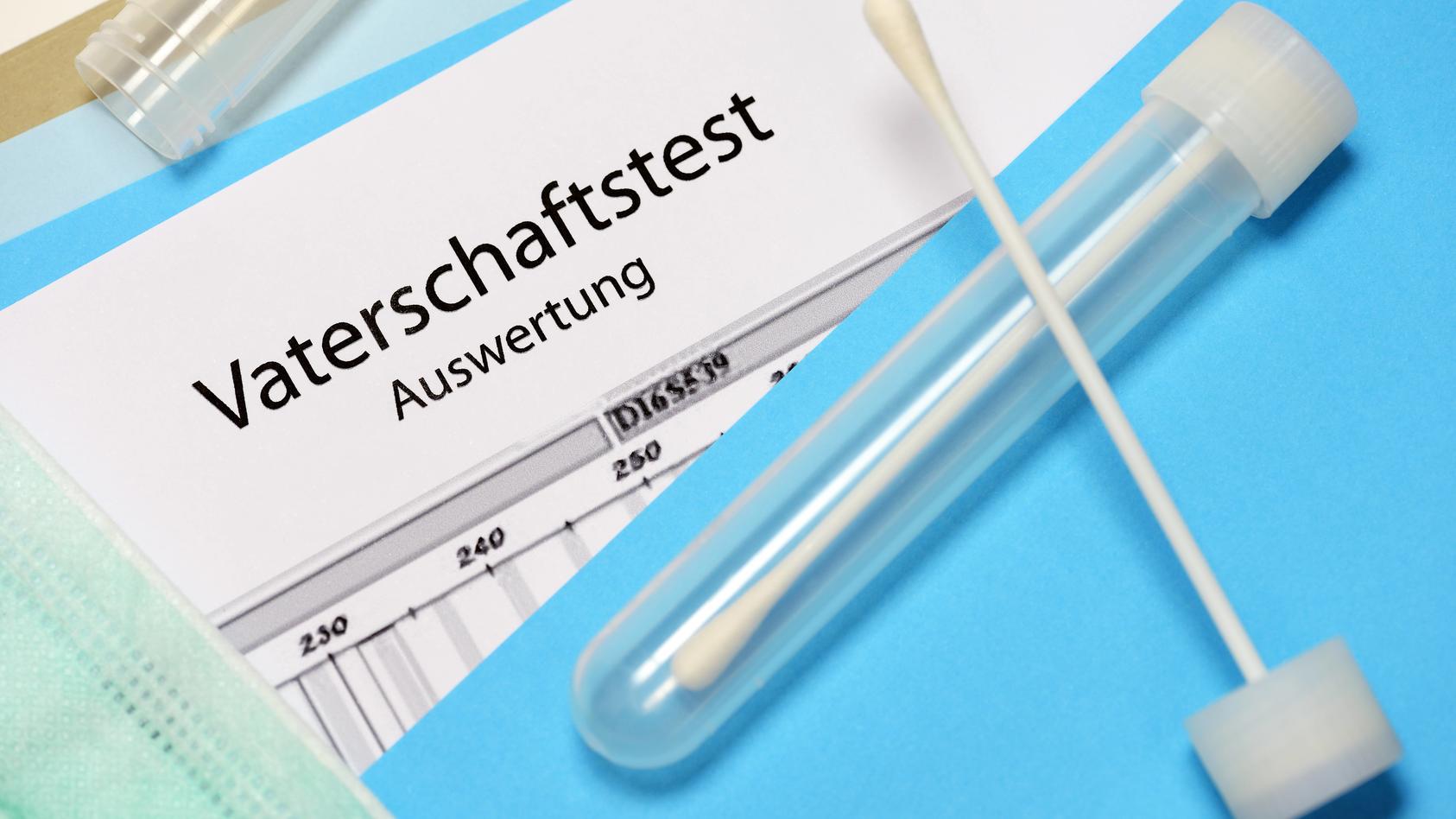 Die FDP-Fraktion will Vaterschaftstests künftig auch vor der Geburt erlauben.