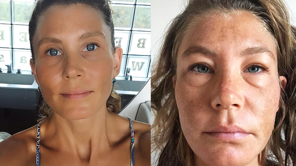 Yoga-Lehrerin Sophie Partik sagt: Trockenfasten hat meine Gesundheit gerettet