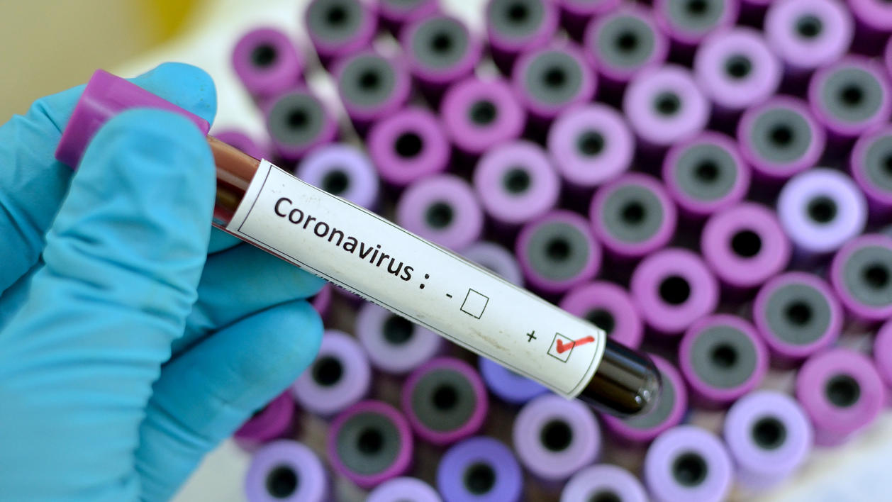 Gentech-Unternehmen Greffex Inc. meldet: Ja, wir haben einen Impfstoff gegen den Corona-Virus entwickelt!