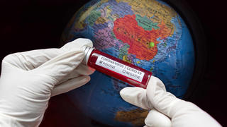  Verbreitung von Coronavirus SARS CoV 2 in die Welt *** Spread of coronavirus SARS CoV 2 to the world Foto:xD.xAnoraganingrumx/xFuturexImage