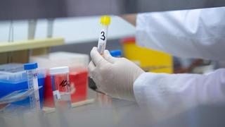 Eine Ärztin zeigt einen Test für das Coronavirus
