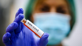  News Bilder des Tages May 13, 2020: May 13, 2020 Malaga Laboratory in Malaga performs analysis of Covip 19 blood samples originally called SARS-Cov-2 during the coronavirus health crisis - ZUMAc161 20200513zapc161001 Copyright: xLorenzoxCarnerox