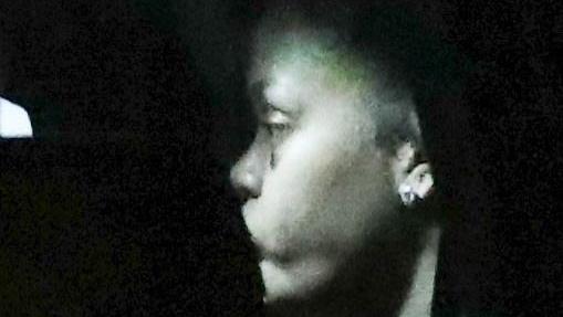 Rihanna mit blauem Auge nach ihrem Roller-Unfall.