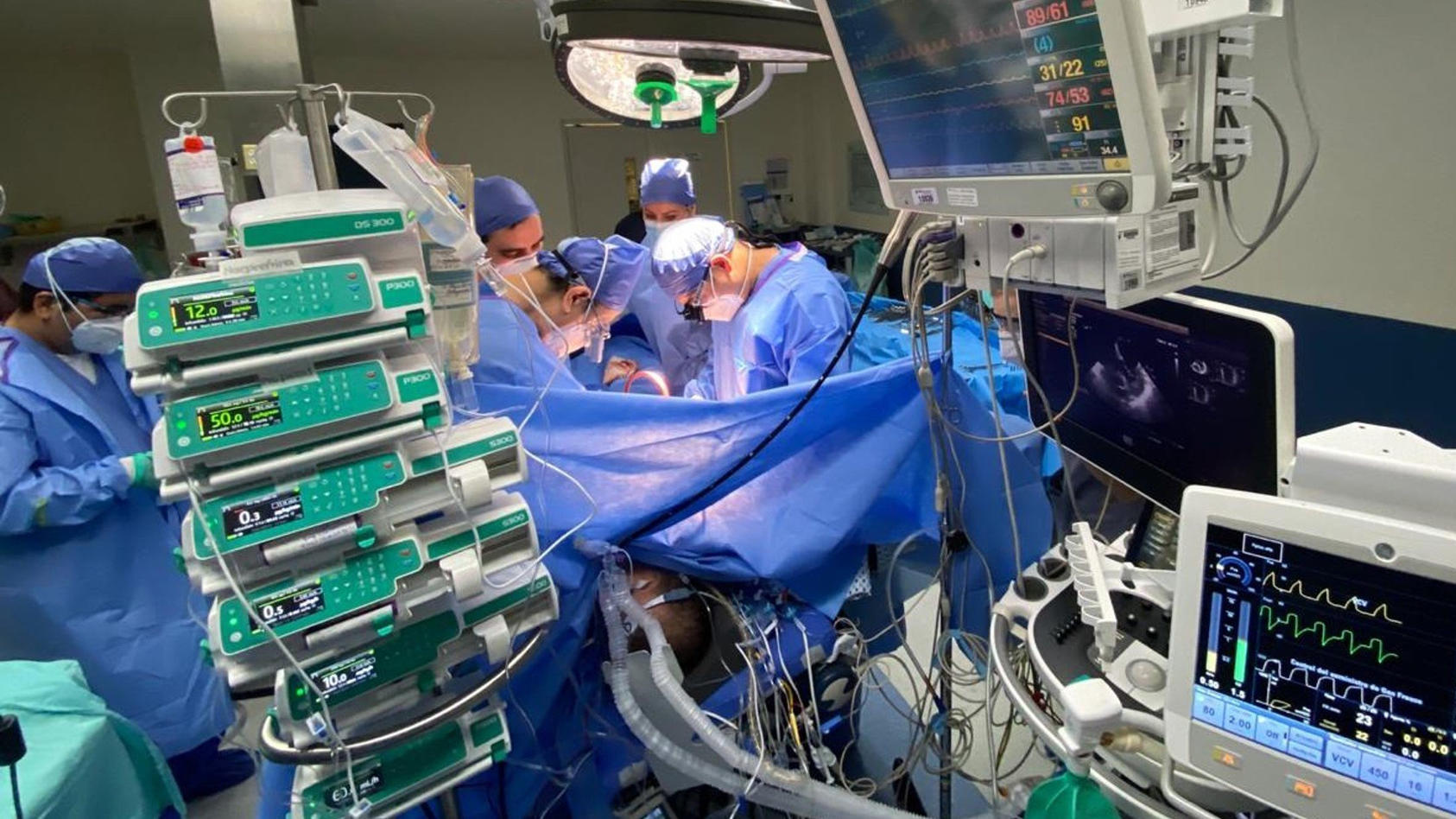 HANDOUT - 31.08.2020, Mexiko, Monterrey: Auf diesem vom Krankenhaus Christus Muguerza zur Verfügung gestellten Bild führt ein Team um den Chirurgen Wong Jaen eine Doppel-Lungentransplatation an einem Covid-19-Überlebenden durch. Der 55-jährige Patien