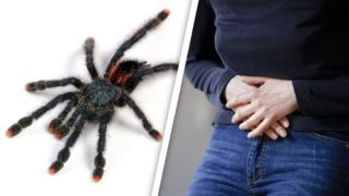 Spinnengift als Schmerzmittel beim Reizdarmsyndrom? Das scheint eine vielversprechende Behandlungsmöglichkeit zu sein!