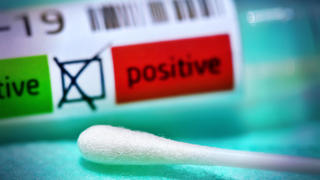  Covid-19-Abstrichröhrchen und Abstrich-Stäbchen, Symbolfoto Coronavirus *** Covid 19 smear tubes and swabs, Symbol Photo Coronavirus