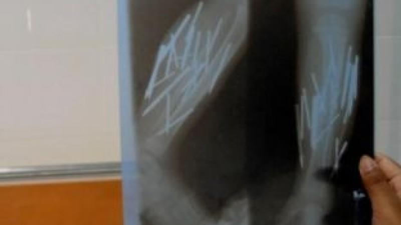 Auf dem Röntgenbild der dreijährigen Safira sind die Nägel eindeutig zu erkennen.