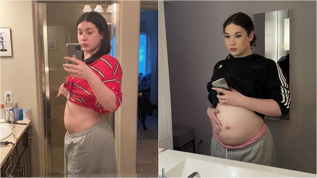 Mikey ist stolz auf ihren Babybauch.