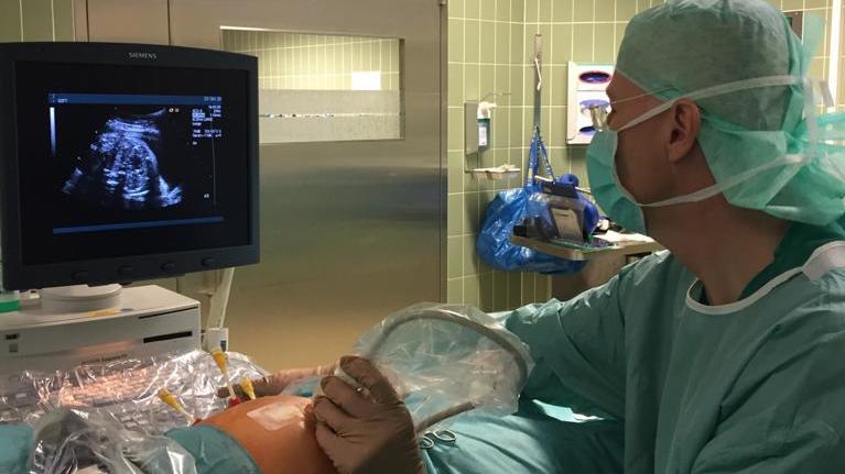 Prof. Dr. Thomas Kohl, Leiter des Deutschen Zentrums für Fetalchirurgie & minimal-invasive Therapie (DZFT), bei einer minimal-invasiven pränatalen Operation.