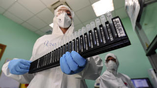  A medical technician works in the laboratory of the Infectious diseases department for coronavirus COVID-19 handling samples of coronavirus COVID 19 tests at the microbiology laboratory of Naples. PUBLICATIONxINxGERxAUTxONLY Copyright: xSalvatorexLaportax/xIPAx/xKontrolabx