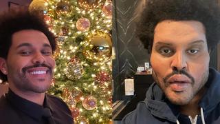 The Weeknd präsentiert sein offenbar komplett operiertes Gesicht