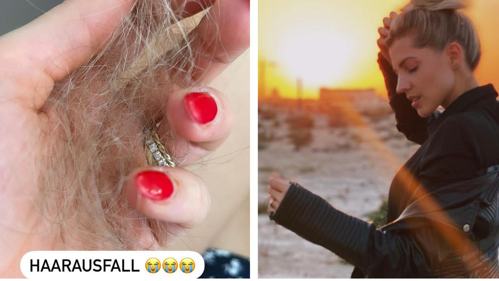 Stressbedingt oder Folge der Schwangerschaft? Sarah Harrison leidet unter Haarausfall.