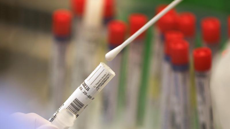 Ein Abstrich wird in einem Labor auf das Coronavirus untersucht. Foto: Oliver Berg/dpa/Symbolbild