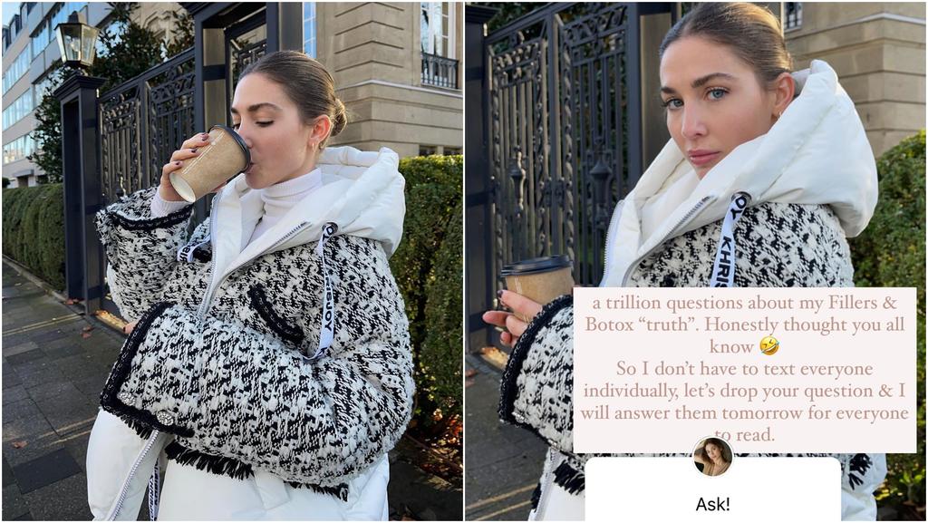 Ann-Kathrin Götze gibt auf Instagram offen zu, dass sie regelmäßig zum Beauty-Doc geht.