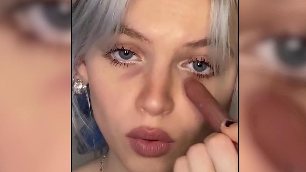 TikTok Trend "Grunge Look": Influencerin Sara-Marie Carstens schminkt sich dunkle Augenringe