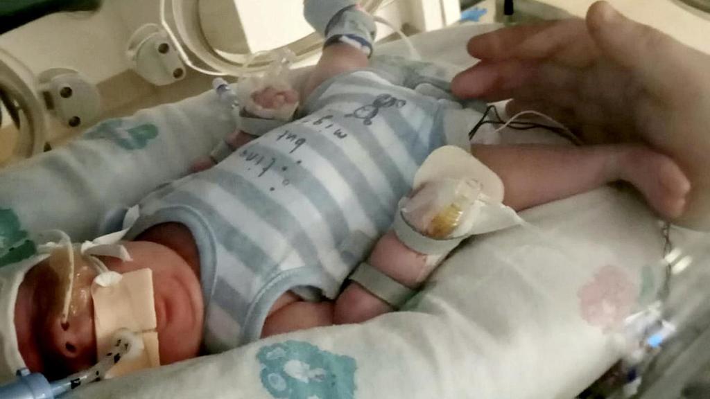 Frühchen Archie erkrankte an Sepsis und Corona