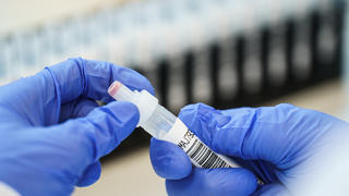 01.02.2021, Rheinland-Pfalz, Ingelheim: Eine Bioscientia-Mitarbeiterin hält eine Probe in den Händen. Die britische Coronavirus-Mutante B.1.1.7 breitet sich zunehmend aus. Das Unternehmen Bioscientia, eines der größten Labore in Deutschland, hilft mit Sequenzer-Automaten bei der Analyse. (zu dpa «Zeitintensiv und hochkomplex: Die Suche nach der Mutante B.1.1.7») Foto: Andreas Arnold/dpa +++ dpa-Bildfunk +++