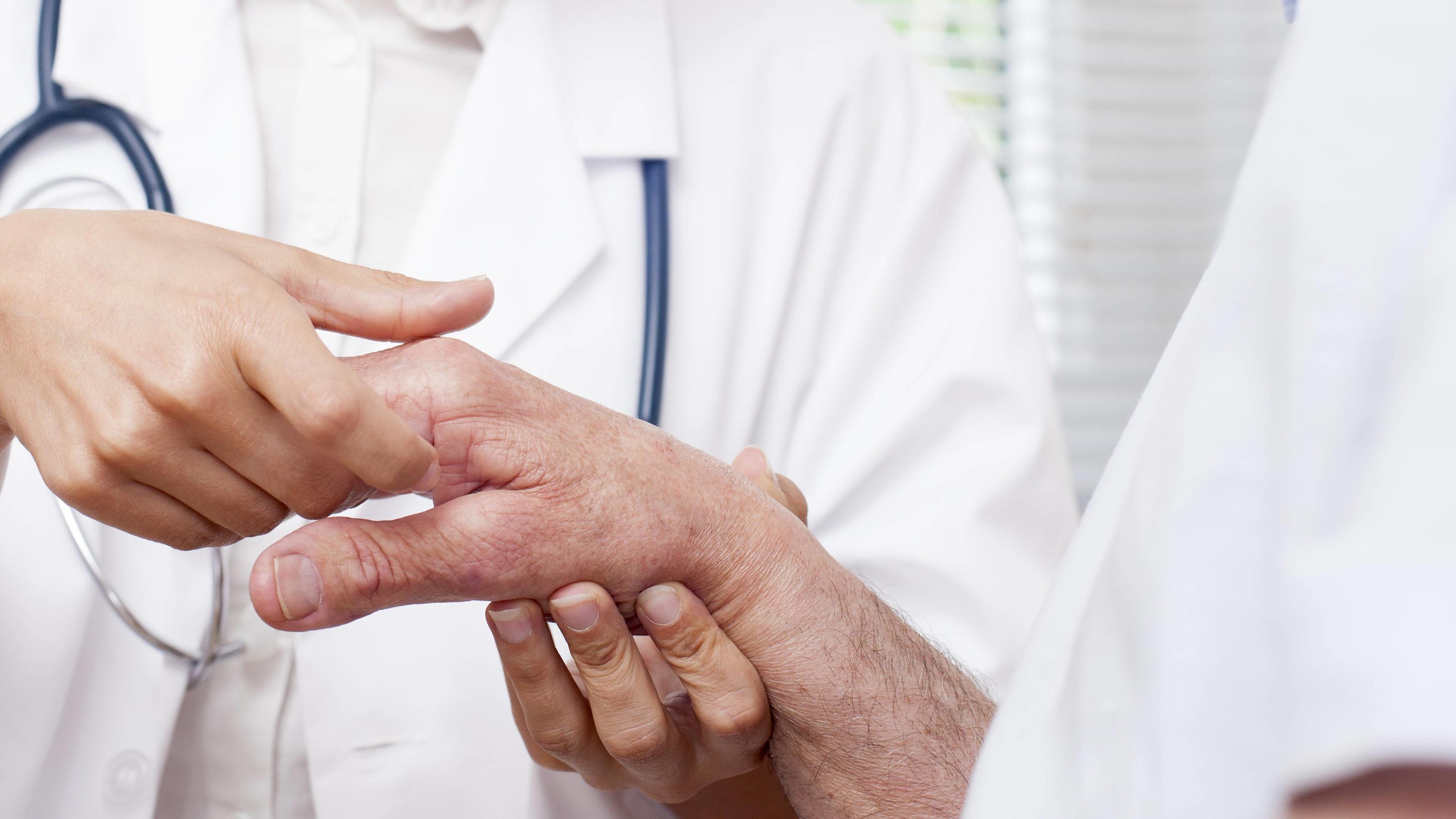 Eine Ärztin untersucht die Hände eines Rheumatikers.