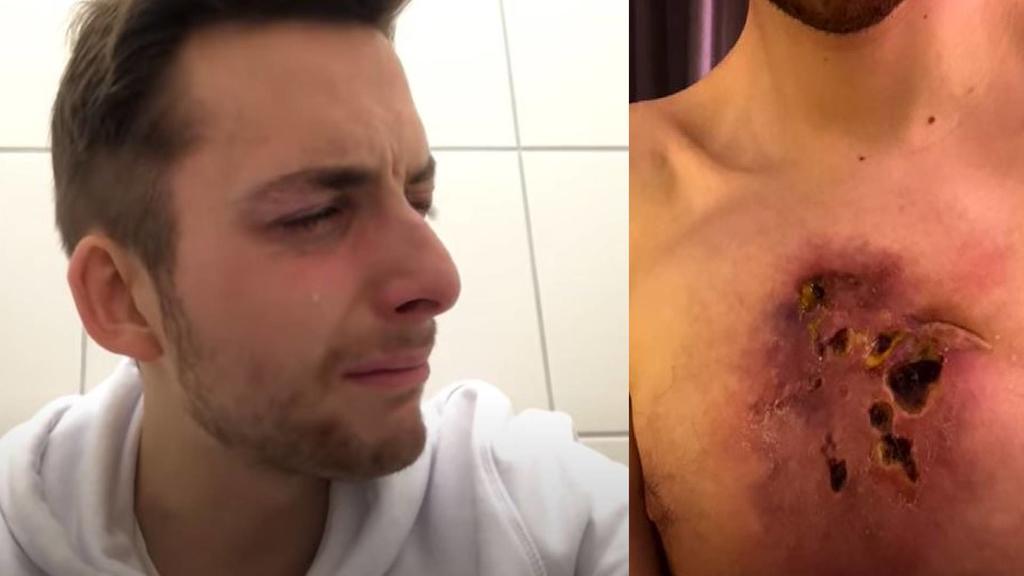 Philipp Mickenbecker zeigt schockierende Bilder seines Tumors.